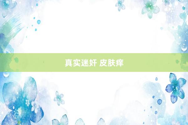 真实迷奸 皮肤痒